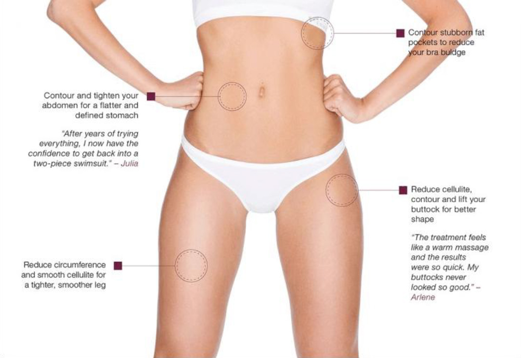 Revitalize Your Body: Exilis Skin Tightening in Perth! Rediscover